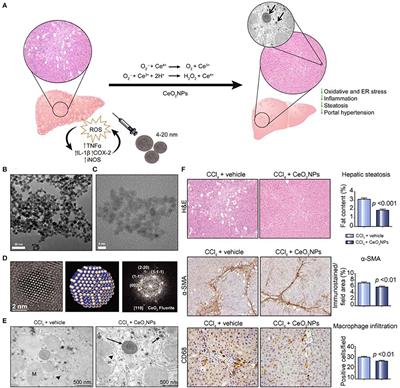 Antioxidant Nanotherapies for the Treatment of Inflammatory Diseases